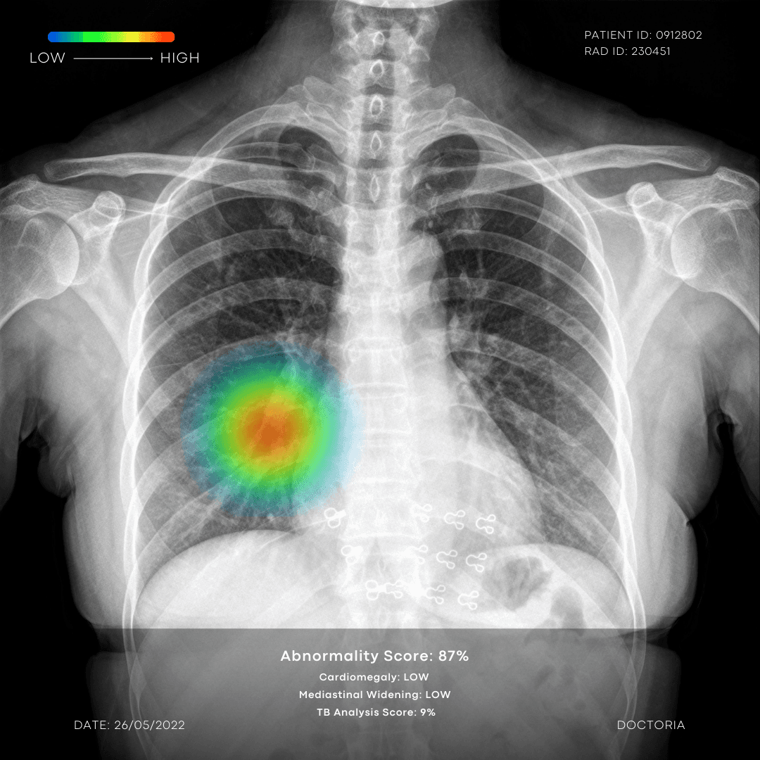 AI-Driven Image Analysis