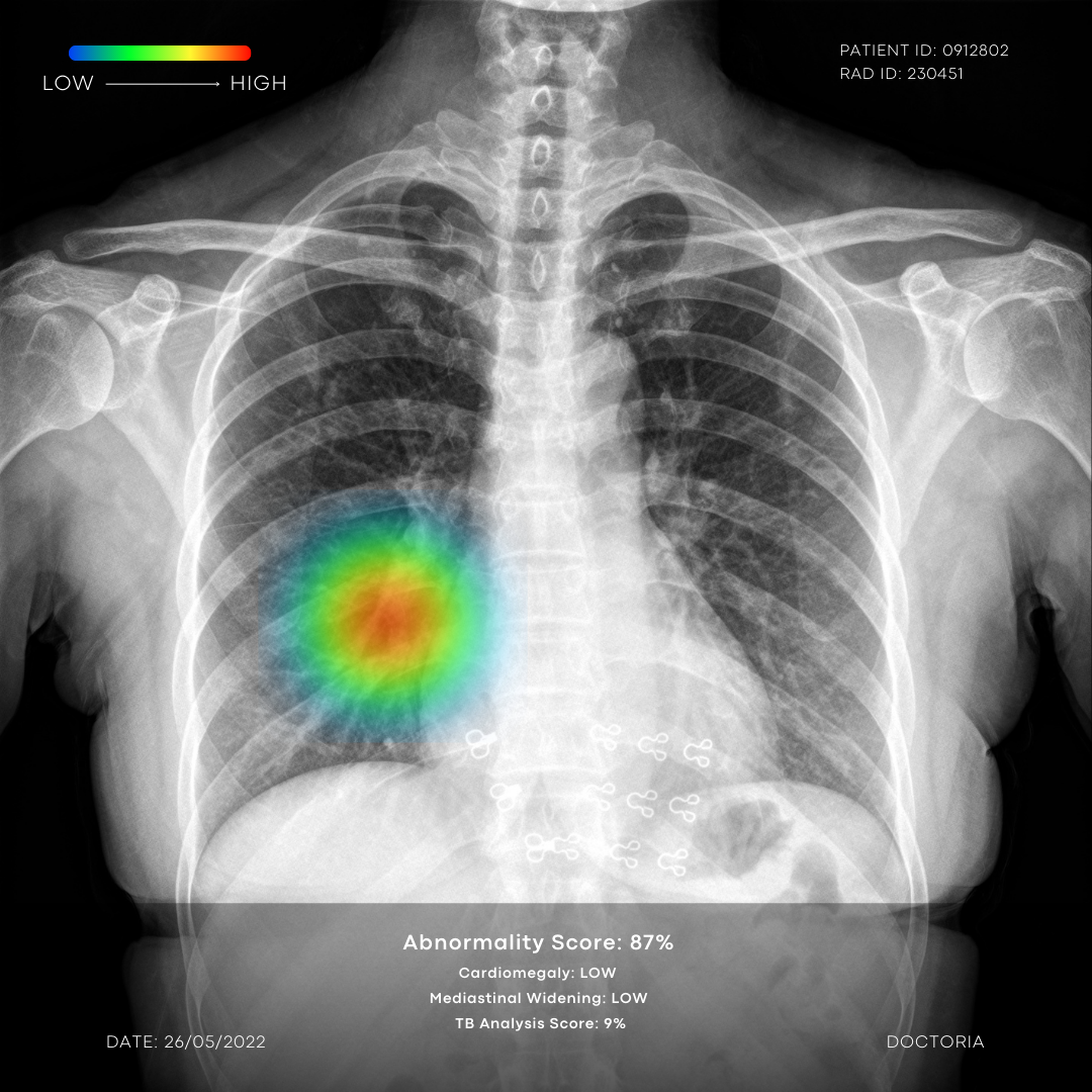 CXR