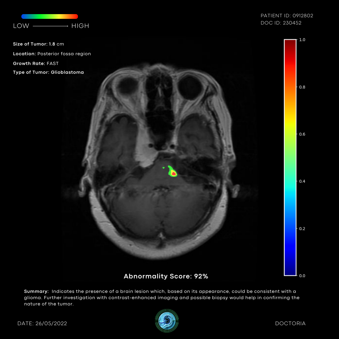 MRI